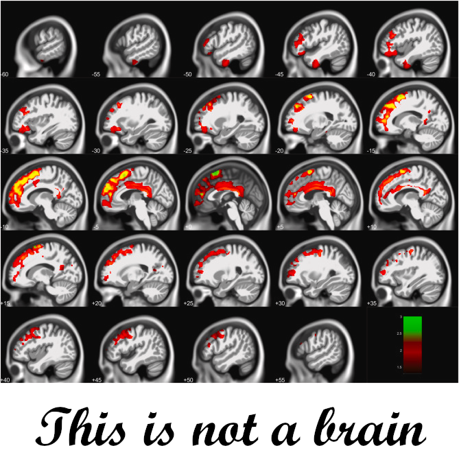 This is not a brain